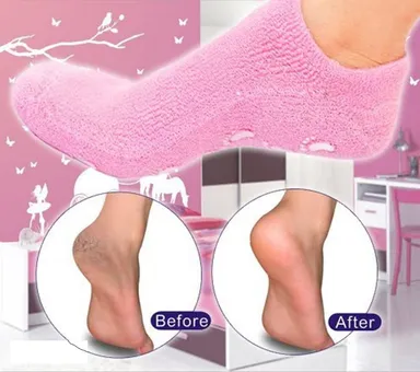 Premium SPA Gel Heel Socks | Colorful Moisturizing Heel Crack Protectors | 1 Pair Healthy Gel Foot Care | Random Color thumbnail 0