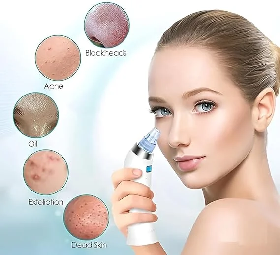 Derma Suction | Blackhead Remover Vacuum Device, Electric Facial Skin Cleanser – Acne & Dead Skin Removal | Gentle 4D Suction for All Skin Types, White image 4