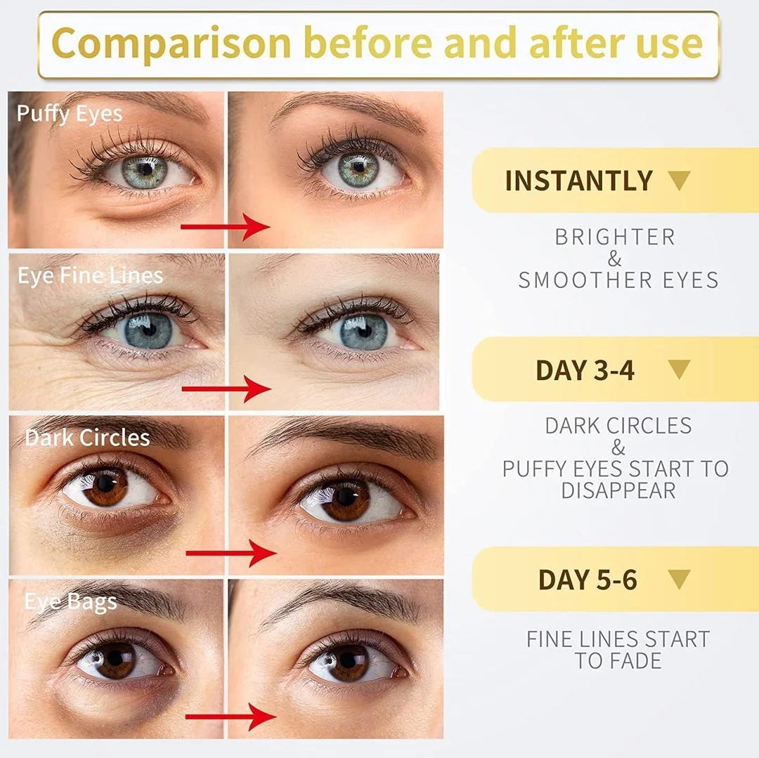 Vrutwa Hydra Anti Wrinkle Eye Serum Patch | Dark Circles & Fine Lines Treatment image 5