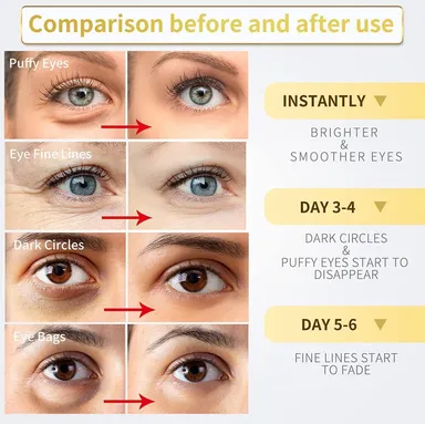 Vrutwa Hydra Anti Wrinkle Eye Serum Patch | Dark Circles & Fine Lines Treatment thumbnail 4