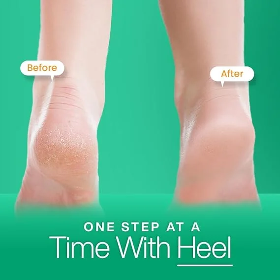 Stepify Silicone Heel Pad Pack of 3 for Heel Pain Relief | Washable Toe-Free Gel Heel Cups for Men & Women| Shock Absorbing Foot Cushion for Plantar Fasciitis| Cracked Heels & Daily Walking Comfort image 4