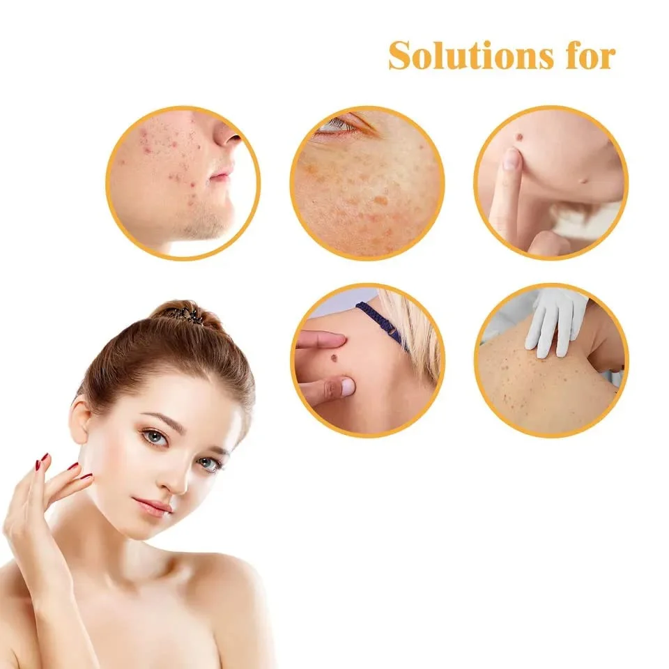 Invisible Hydrocolloid Pimple & Skin-Tag Patch Dots – 36-Pack Acne Spot Remover for All Skin Types (Face & Body) image 3