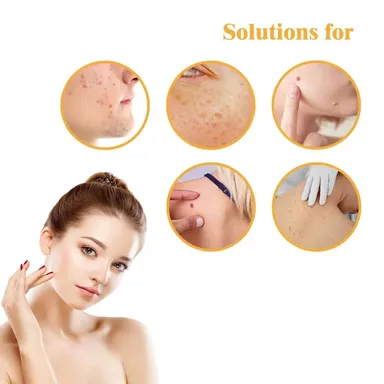 Invisible Hydrocolloid Pimple & Skin-Tag Patch Dots – 36-Pack Acne Spot Remover for All Skin Types (Face & Body) thumbnail 2