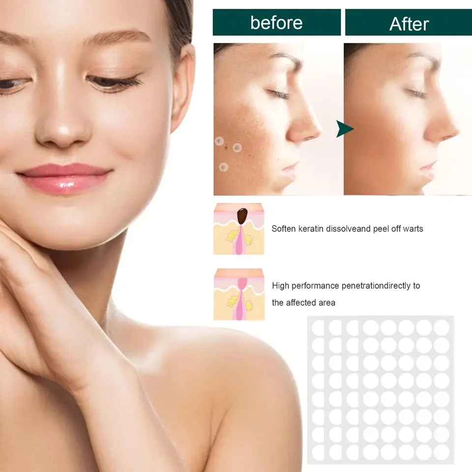 Invisible Hydrocolloid Pimple & Skin-Tag Patch Dots – 36-Pack Acne Spot Remover for All Skin Types (Face & Body) image 6