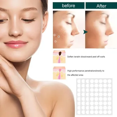 Invisible Hydrocolloid Pimple & Skin-Tag Patch Dots – 36-Pack Acne Spot Remover for All Skin Types (Face & Body) thumbnail 5