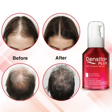 Regaliz Densita Plus Hair Growth Serum 60 ml |With Redensyl, Anagain & Rosemary Oil for Hair Fall Reduction, Strengthened Roots & Enhanced Hair Growth (Paraben-Free) thumbnail 4