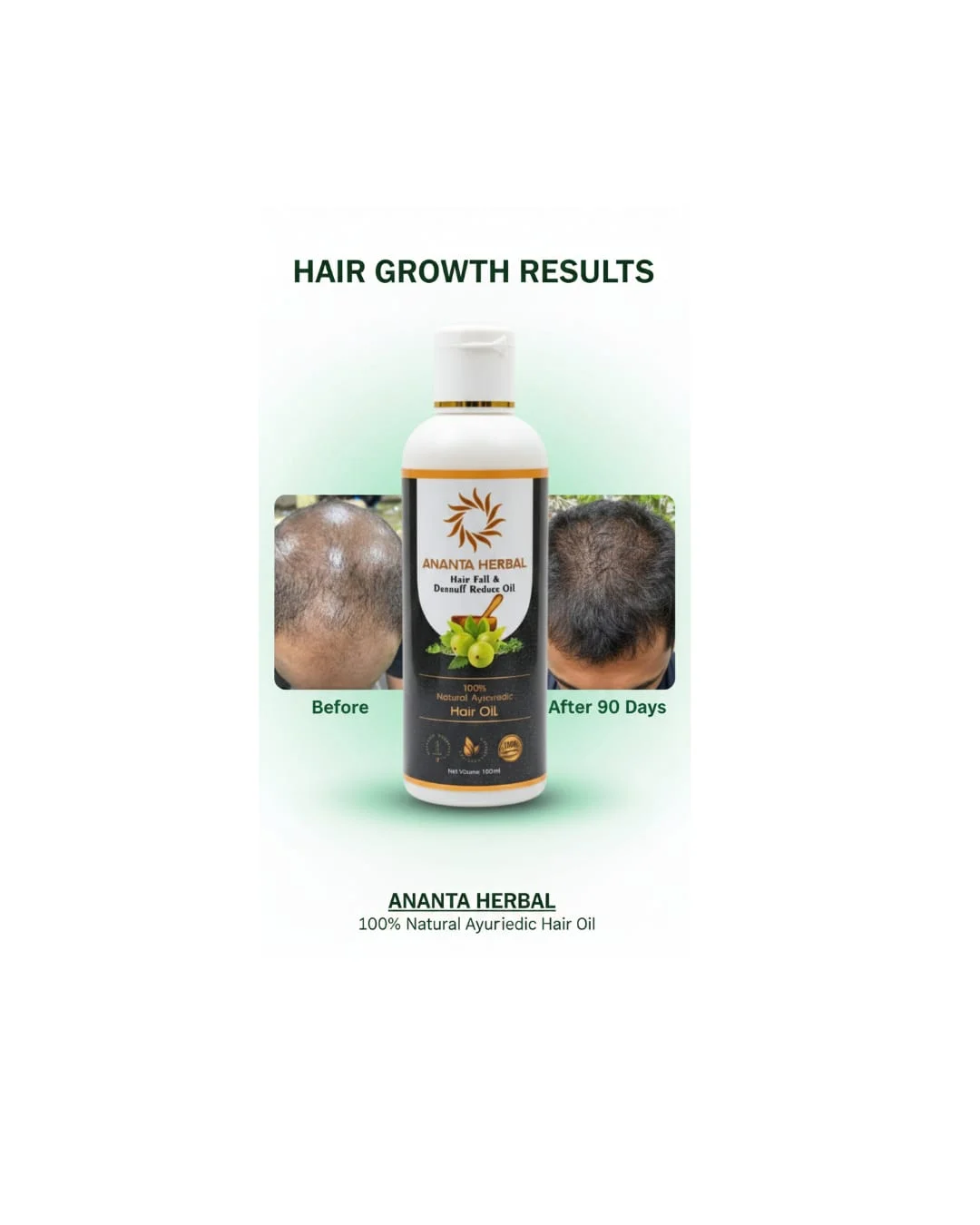 Ananta Herbal Hair Fall & Dandruff Reduce Oil 100 ml Ayurvedic Herbal Hair Growth Oil with Amla Bhringraj Natural Scalp Nourish Reduce Hair Fall & Dandruff Daily Use image 2