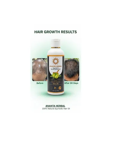 Ananta Herbal Hair Fall & Dandruff Reduce Oil 100 ml Ayurvedic Herbal Hair Growth Oil with Amla Bhringraj Natural Scalp Nourish Reduce Hair Fall & Dandruff Daily Use thumbnail 1