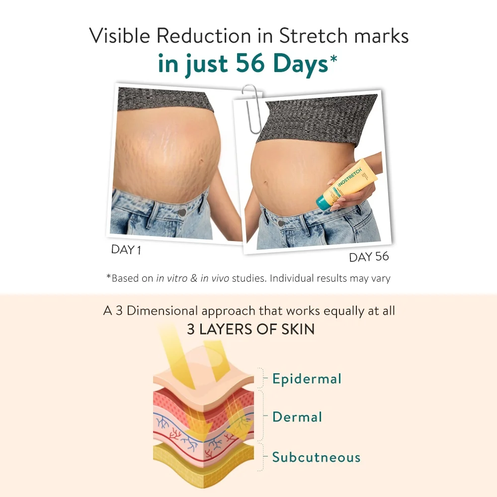 Inostretch Stretch Mark Cream 60gm | Reduce Stretch Marks & Scars with Rutin, Shea Butter, Two Peptides, Coconut oil, Sunflower seed oil, Green Bean seed extract | Paraben Free & Dermatologist Approved Stretch Mark Removal Cream (Pack of 1) image 4