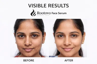 Rootovo Daily Brightening Face Serum 15% Vitamin C 5% Niacinamide with Hyaluronic Acid Skin Brightening Anti Pigmentation Hydrating Face Serum for Glowing Skin 30ml thumbnail 4
