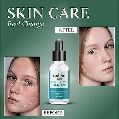 Skin Brightening Serum for Whitening & Brightening 30ml | Anti-Dark Spots & Glowing Skin Face Serum | Natural Skin Care, Vitamin C & Hyaluronic Acid | Lightweight Daily Moisturising Serum thumbnail 1