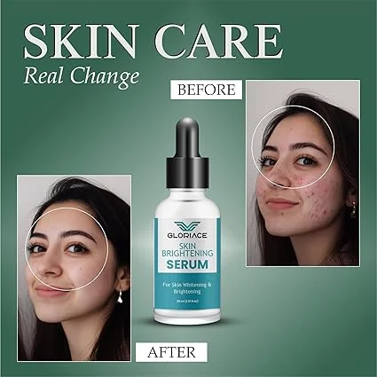 Skin Brightening Serum for Whitening & Brightening 30ml | Anti-Dark Spots & Glowing Skin Face Serum | Natural Skin Care, Vitamin C & Hyaluronic Acid | Lightweight Daily Moisturising Serum image 3