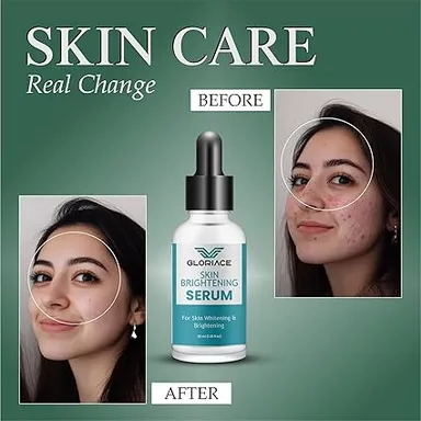 Skin Brightening Serum for Whitening & Brightening 30ml | Anti-Dark Spots & Glowing Skin Face Serum | Natural Skin Care, Vitamin C & Hyaluronic Acid | Lightweight Daily Moisturising Serum thumbnail 2