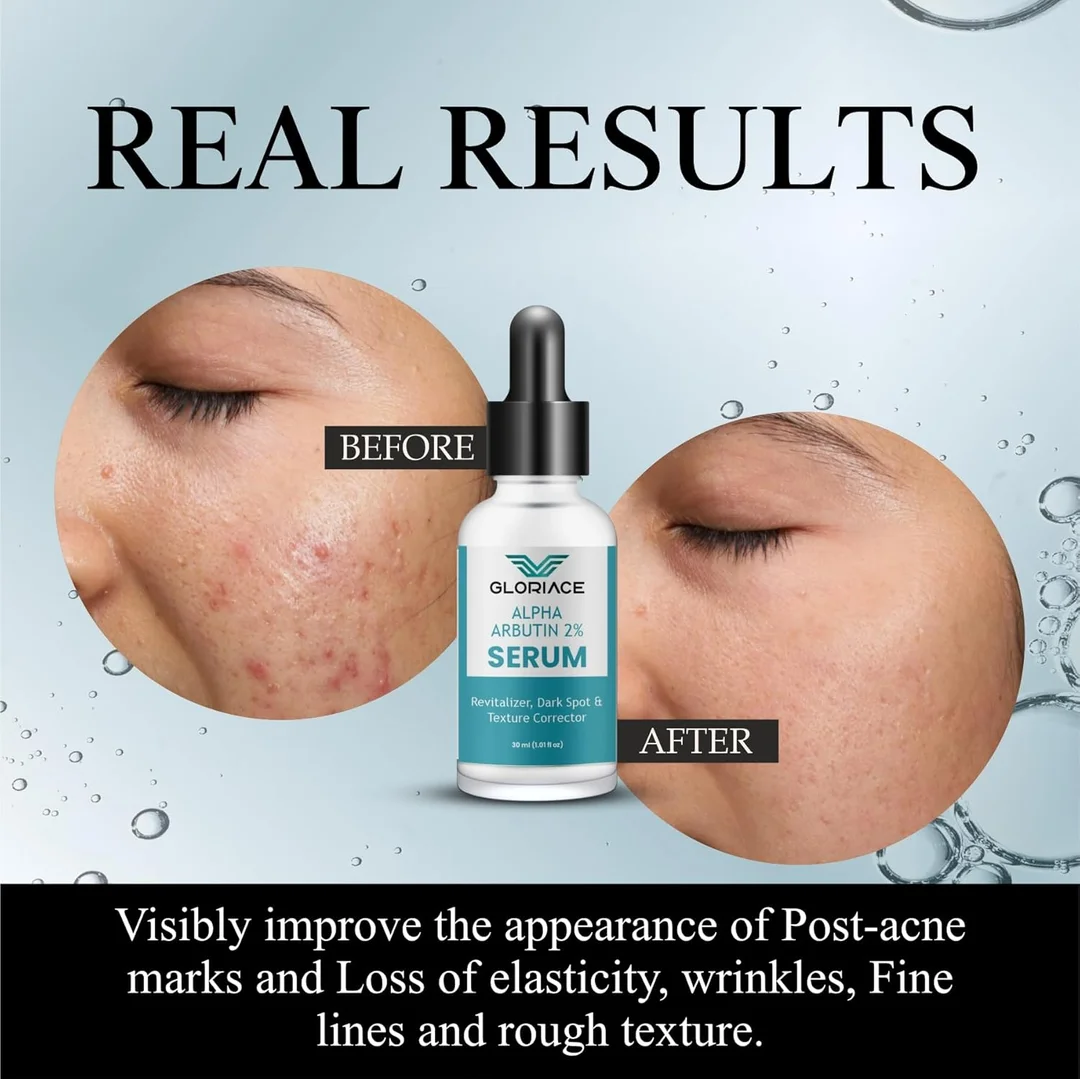 Alpha Arbutin 2% Face Serum 30ml for Dark Spots, Pigmentation, Acne Marks, Uneven Skin Tone, Texture Correction & Skin Brightening with Hydrating Revitalizer Formula image 3