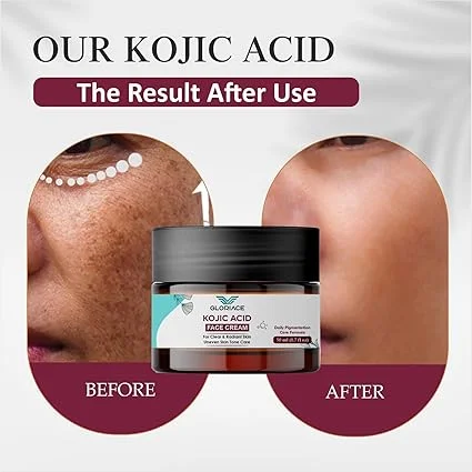 Kojic Acid Face Cream 50ml Daily Pigmentation Care Cream for Dark Spots Uneven Skin Tone Brightening Clear Radiant Skin Moisturising Skincare Cream for Women and Men image 2