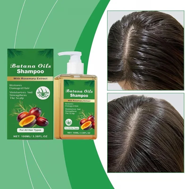 ELHAE Batana Oil Shampoo 200ml with Rosemary Extract for Hair Growth Control Hair Fall Repair Damage Strengthening Moisturising Scalp Nourishing Daily Use Sulphate Free Shampoo for All Hair Types image 2