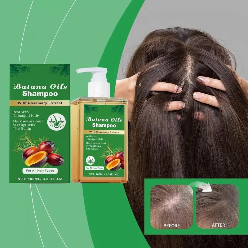 ELHAE Batana Oil Shampoo 200ml with Rosemary Extract for Hair Growth Control Hair Fall Repair Damage Strengthening Moisturising Scalp Nourishing Daily Use Sulphate Free Shampoo for All Hair Types image 3