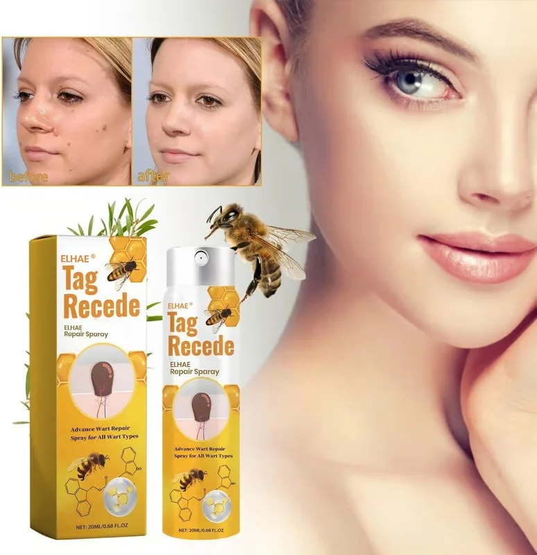 ELHAE Bee Venom Skin Tag Removal Spray 20ml Fast Acting Wart Corn Mole Remover Liquid Natural Herbal Tag Recede Treatment for Face Neck Underarms Painless Skin Repair Solution image 2