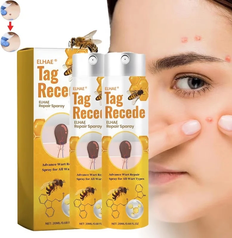 ELHAE Bee Venom Skin Tag Removal Spray 20ml Fast Acting Wart Corn Mole Remover Liquid Natural Herbal Tag Recede Treatment for Face Neck Underarms Painless Skin Repair Solution image 3