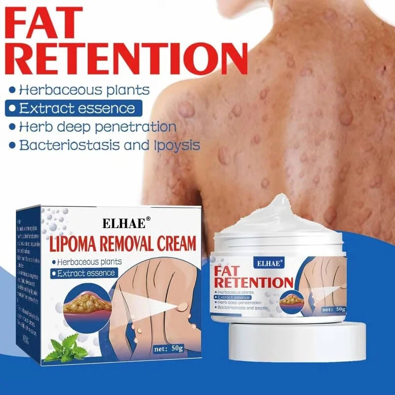 ELHAE Herbal Lipoma Removal Cream Ointment for Fatty Lump Reduction Skin Tag Softening Natural Chinese Herbal Formula Painless Safe Skin Care 20g image 2