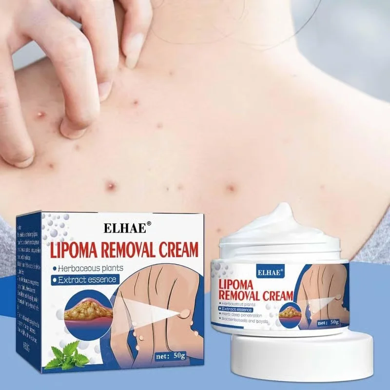 ELHAE Herbal Lipoma Removal Cream Ointment for Fatty Lump Reduction Skin Tag Softening Natural Chinese Herbal Formula Painless Safe Skin Care 20g image 1