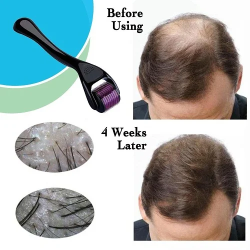 Derma Roller for Hair & Scalp Care' | Microneedle Scalp Massage Roller Helps Support Hair Growth Routine image 3
