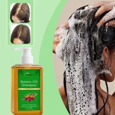 Batana Oil Shampoo with Rosemary Extract for Hair Growth | Deeply Moisturizes and Restores Damaged Hair | Scalp Strengthening Formula for Smooth and Shiny Hair (100ml) thumbnail 1