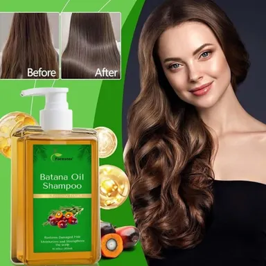 Forester Batana Oil Shampoo with Rosemary Extract for Hair Growth and Scalp Care | Pack of 2 (100ml Each) thumbnail 1
