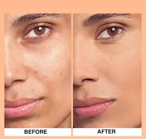 Best Waterproof Foundation for Indian Skin | Long Lasting Full Coverage Matte Finish Liquid Foundation | Lightweight Natural Glow Makeup Base for Daily Use & Bridal Makeup – ONHP Herbal Cosmetics image 2