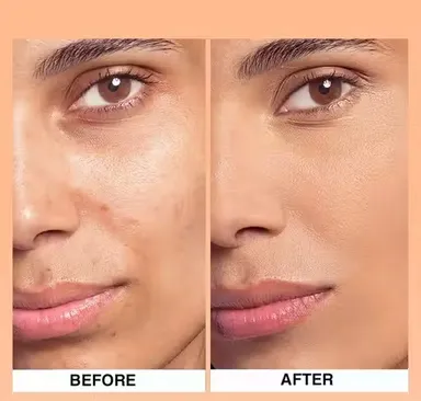 Best Waterproof Foundation for Indian Skin | Long Lasting Full Coverage Matte Finish Liquid Foundation | Lightweight Natural Glow Makeup Base for Daily Use & Bridal Makeup – ONHP Herbal Cosmetics thumbnail 1