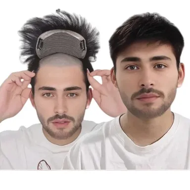 Ritzkart Men's Black Short Straight Hair Patch with PU Skin Base Lace Front Clip-On Synthetic Hair Topper Natural Hairline Hair Replacement System for Baldness Coverage thumbnail 2