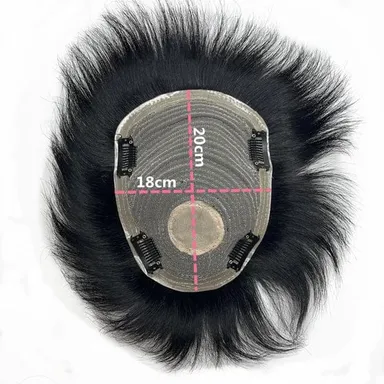 Ritzkart Men's Black Short Straight Hair Patch with PU Skin Base Lace Front Clip-On Synthetic Hair Topper Natural Hairline Hair Replacement System for Baldness Coverage thumbnail 1