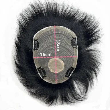 Ritzkart Men's Black Short Straight Hair Patch with PU Skin Base Lace Front Clip-On Synthetic Hair Topper Natural Hairline Hair Replacement System for Baldness Coverage thumbnail 3